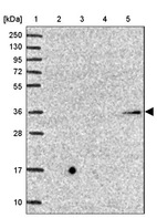 Lane 1: Marker [kDa] 250, 130, 95, 72, 55, 36, 28, 17, 10_br/_Lane 2: Human cell line RT-4_br/_Lane 3: Human cell line U-251MG sp_br/_Lane 4: Human plasma (IgG/HSA depleted)_br/_Lane 5: Human liver tissue