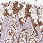 Immunohistochemical staining of human rectum shows strong cytoplasmic positivity in glandular cells.