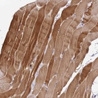 Immunohistochemical staining of human skeletal muscle shows strong cytoplasmic positivity in myocytes.