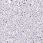 Immunohistochemical staining of human liver shows no positivity in hepatocytes as expected.
