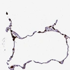 Immunohistochemical staining of human lung shows high expression.