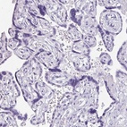 Immunohistochemical staining of human placenta shows low expression as expected.