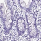 Immunohistochemical staining of human colon using Anti-NAPSA antibody HPA047744.