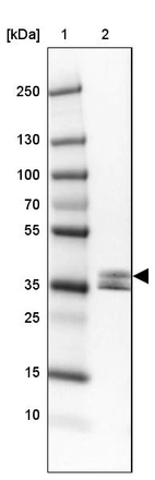 Lane 1: Marker [kDa] 250, 130, 100, 70, 55, 35, 25, 15, 10_br/_Lane 2: Human Lung tissue