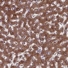 Anti-HP Antibody