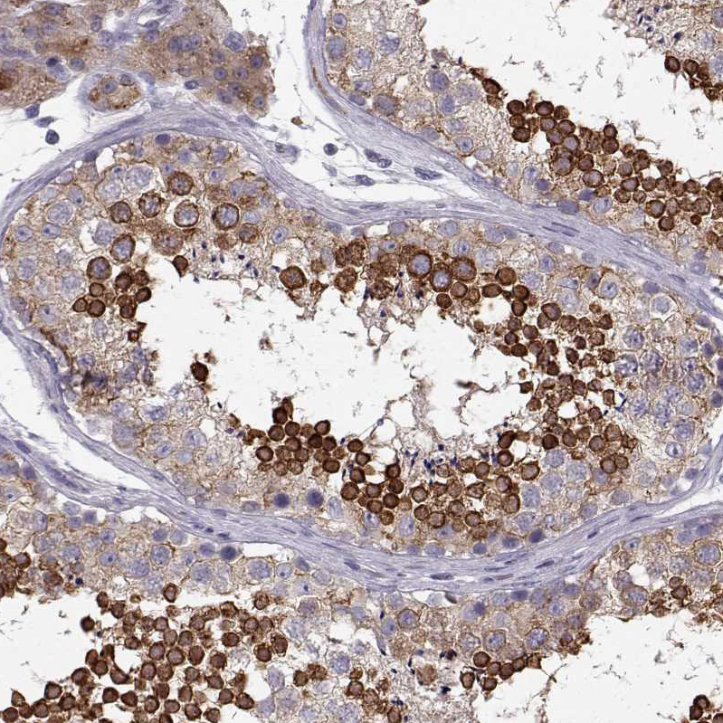 Anti-ELOVL5 Antibody