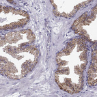 Anti-ELOVL5 Antibody