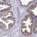 Immunohistochemical staining of human prostate shows moderate granular cytoplasmic positivity in glandular cells.