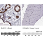 Immunohistochemistry analysis in human breast and skeletal muscle tissues using HPA047752 antibody. Corresponding ELOVL5 RNA-seq data are presented for the same tissues.