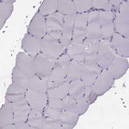 Immunohistochemical staining of human skeletal muscle shows no positivity in myocytes as expected.