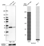 Western blot analysis in human cell lines U-251MG and MCF-7 using Anti-ELOVL5 antibody. Corresponding ELOVL5 RNA-seq data are presented for the same cell lines. Loading control: Anti-GAPDH.