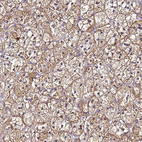 Anti-SMIM4 Antibody