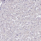 Immunohistochemical staining of human liver shows no membranous positivity in hepatocytes.