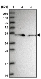 Lane 1: Marker [kDa] 250, 130, 95, 72, 55, 36, 28, 17, 10_br/_Lane 2: Human cell line RT-4_br/_Lane 3: Human cell line U-251MG sp