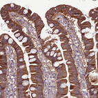 Anti-GPN3 Antibody