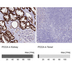 Anti-PCCA Antibody