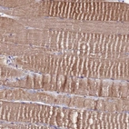 Immunohistochemical staining of human skeletal muscle shows moderate cytoplasmic positivity in myocytes.