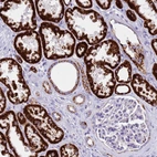 Immunohistochemical staining of human kidney shows strong granular cytoplasmic positivity in cells in tubules.