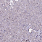 Immunohistochemical staining of human pancreas shows no positivity in exocrine glandular cells as expected.