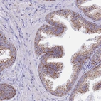 Immunohistochemical staining of human prostate shows moderate granular cytoplasmic positivity in glandular cells.