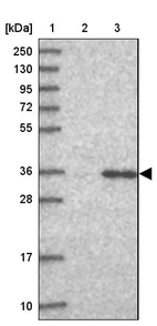 Lane 1: Marker [kDa] 250, 130, 95, 72, 55, 36, 28, 17, 10_br/_Lane 2: Human cell line RT-4_br/_Lane 3: Human cell line U-251MG sp