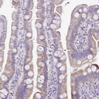 Immunohistochemical staining of human gastrointestinal shows weak cytoplasmic positivity in glandular cells.