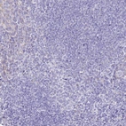 Immunohistochemical staining of human tonsil shows no positivity in lymphoid cells as expected.