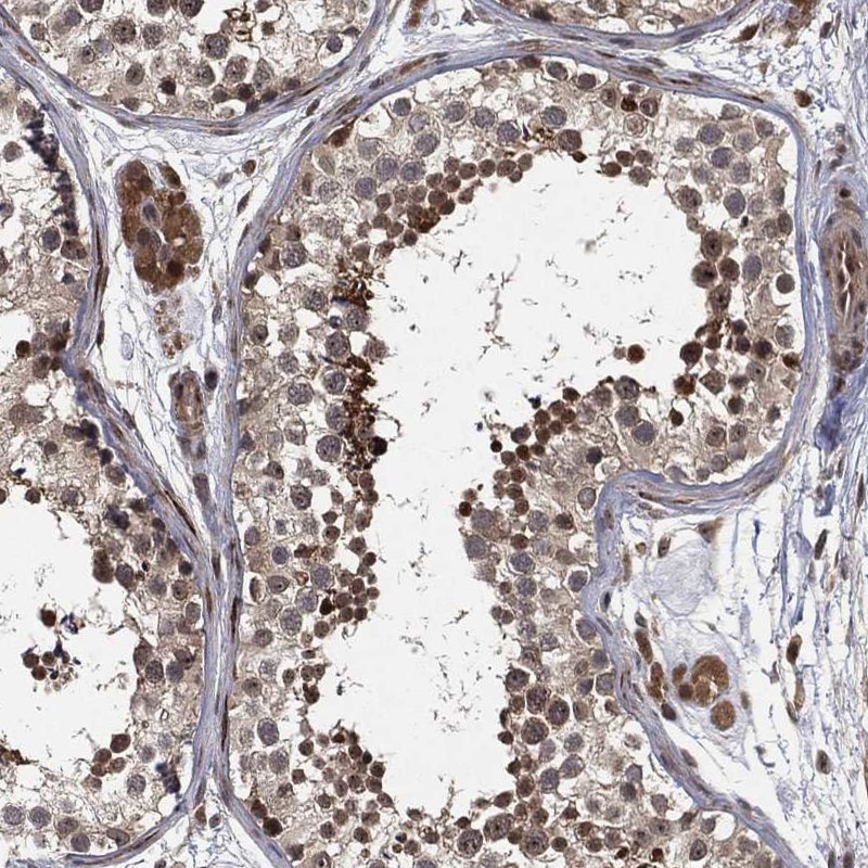 Anti-CAPRIN2 Antibody