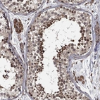 Anti-CAPRIN2 Antibody