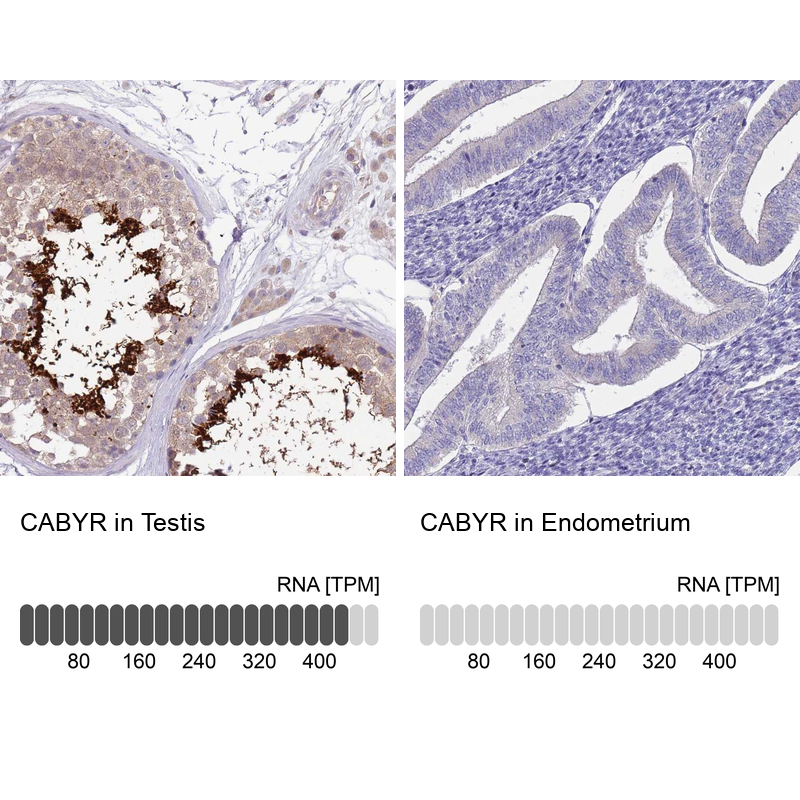 Anti-CABYR Antibody