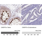 Anti-CABYR Antibody
