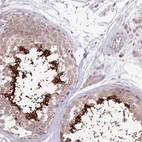 Immunohistochemical staining of human testis shows high expression.