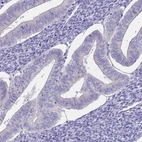 Immunohistochemical staining of human endometrium shows low expression as expected.