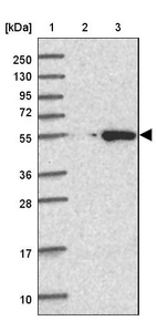 Lane 1: Marker [kDa] 250, 130, 95, 72, 55, 36, 28, 17, 10_br/_Lane 2: Human cell line RT-4_br/_Lane 3: Human cell line U-251MG sp