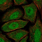 Immunofluorescent staining of human cell line SiHa shows localization to nucleoplasm & cytosol.