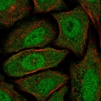 Immunofluorescent staining of human cell line SiHa shows localization to nucleoplasm & cytosol.