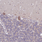 Immunohistochemical staining of human cerebellum shows strong cytoplasmic positivity in Purkinje cells.