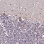 Immunohistochemical staining of human cerebellum shows strong cytoplasmic positivity in Purkinje cells.