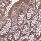 Immunohistochemical staining of human colon shows strong cytoplasmic positivity in glandular cells.