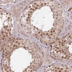 Immunohistochemical staining of human testis shows moderate nuclear positivity in cells in seminiferous ducts.