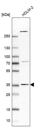 Western blot analysis in human cell line HDLM-2.