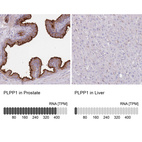 Anti-PLPP1 Antibody