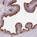 Immunohistochemical staining of human prostate shows high expression.