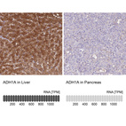 Anti-ADH1A Antibody