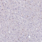 Immunohistochemical staining of human liver shows low expression as expected.