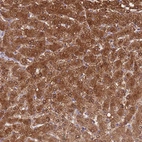 Immunohistochemical staining of human liver shows strong cytoplasmic positivity in hepatocytes.