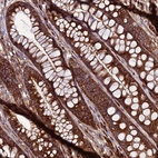 Anti-ZC3HAV1 Antibody