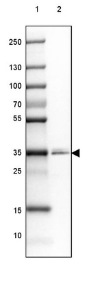 Anti-PLPP1 Antibody