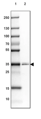 Lane 1: Marker [kDa] 250, 130, 100, 70, 55, 35, 25, 15, 10_br/_Lane 2: Human Prostate tissue