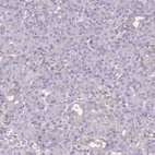 Anti-ADH1A Antibody